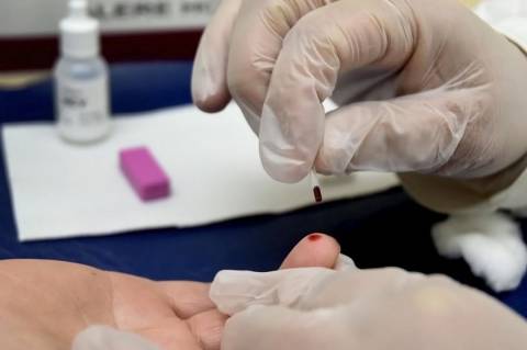Casos de hepatite A aumentam 54,5% em 2024 no Brasil, segundo MS